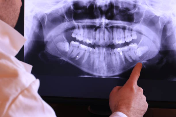 Best Root Canal Emergency Dentist  in Ovid, MI