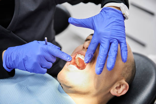 Best Knocked-Out Tooth Emergency  in Ovid, MI