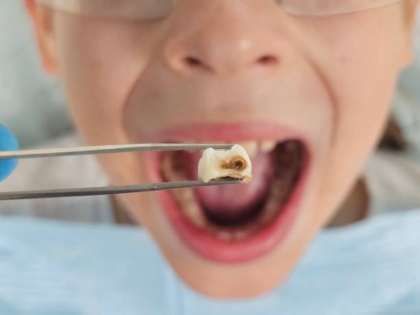 Best Broken Tooth Emergency  in Ovid, MI